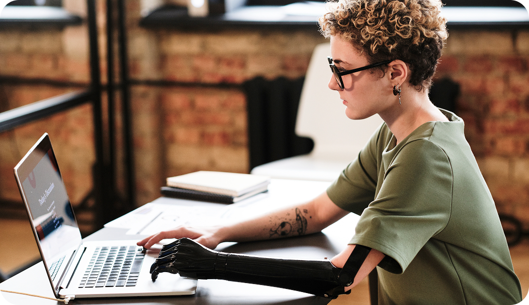 Mujer con discapacidad usando prótesis de mano trabajando en una laptop en ambiente de oficina